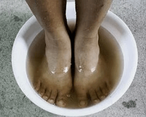 Normas para o tratamento dos fungos das uñas