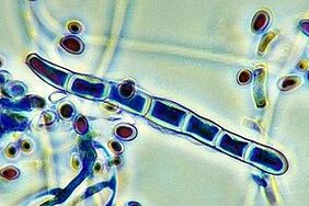 Fungos patóxenos das unhas baixo o microscopio