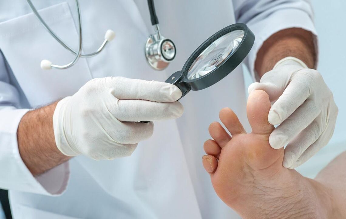 O doutor examina as uñas en busca de fungos