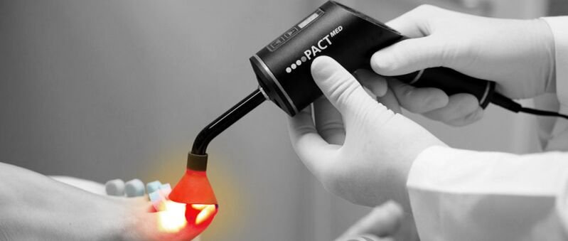 Tratamento con láser para fungos nas unhas dos pés